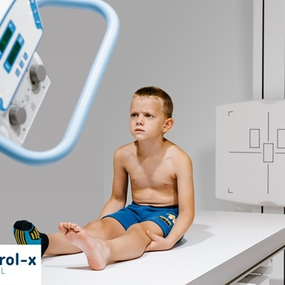 Hệ thống X-quang kỹ thuật số 1000mA Control- X Medical Perform-X F100